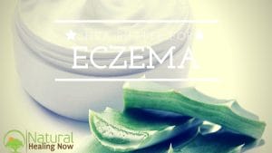 Discover The Many Benefits of Shea Butter For Eczema