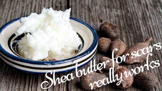 Use Shea Butter For Your Scars