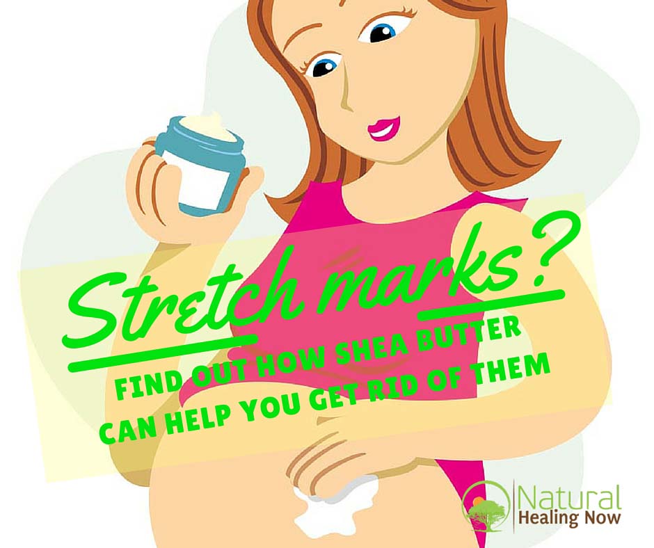How shea butter for stretch marks works