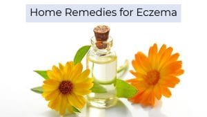 What are the different eczema home remedies?